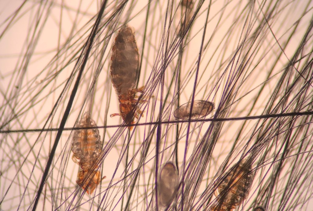 Milben unter dem Mikroskop